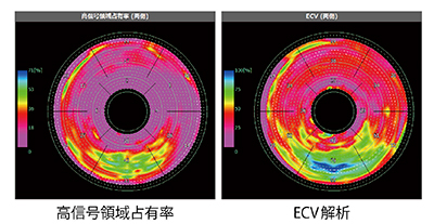 図3　ECV解析画像