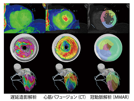図6　心臓フュージョン画像