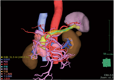 図1　CT画像による膵臓三次元構築画像
