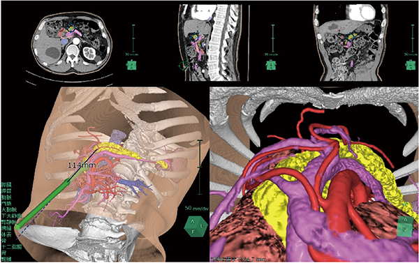 図5　鏡視下シミュレータによる仮想内視鏡ビュー