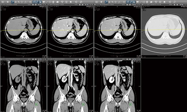図2　SRPを用いた急性腹症の造影CT検査での画像表示レイアウト