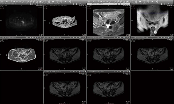 図3　SRPを用いた前立腺のMRI検査での画像表示レイアウト