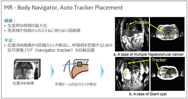 図1　Body Navigatorによるnavigator trackerの自動設定
