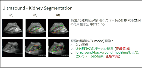 図2　腎臓の自動セグメンテーションを行うKidney Segmentation
