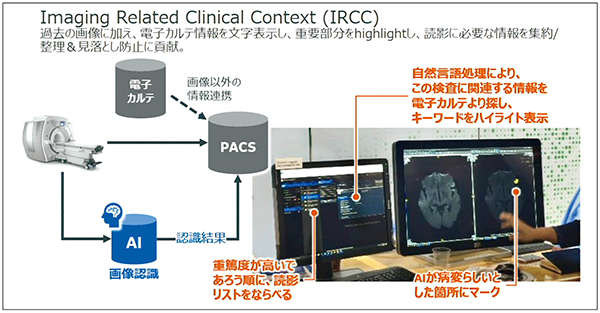 図3　IRCC機能