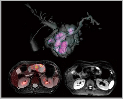 図6　肝胆膵のPET/MRI融合画像