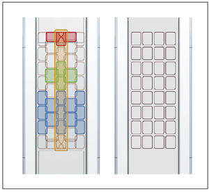 図5　GEM Posterior Array（左）と従来の埋め込み式コイル（右）の構造比較