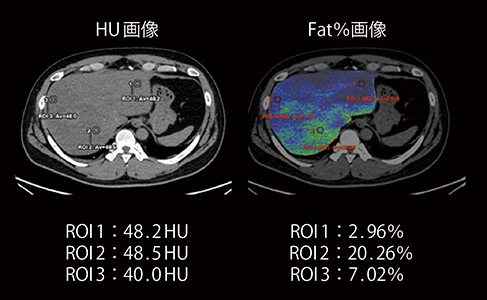 図2　HUと脂肪含有率の比較