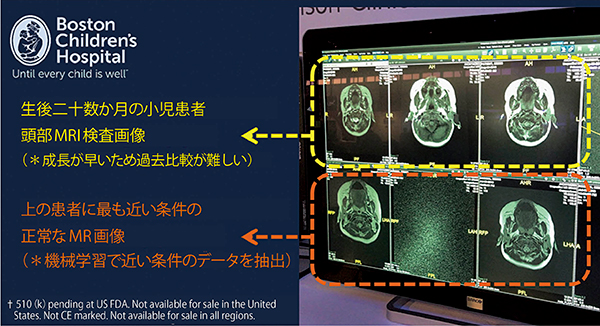 図3　小児の頭部MR画像診断支援AIアプリケーション（W.I.P.）