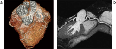 図4　3D Heartによる冠動脈撮像