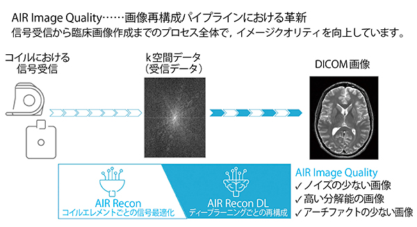 図1　AIR Technologyによる次世代の画像再構成パイプライン