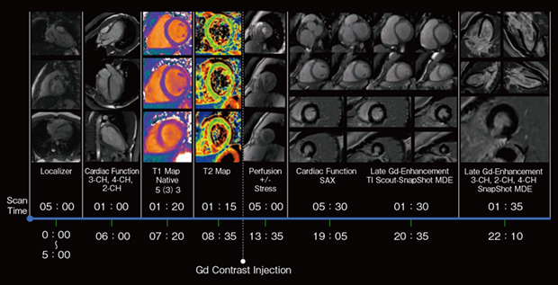 図4　短時間（＜30min）心臓MRI検査の一例