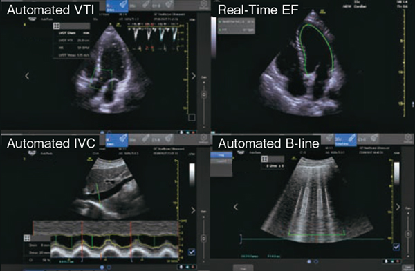 図2　4つのAuto Tool