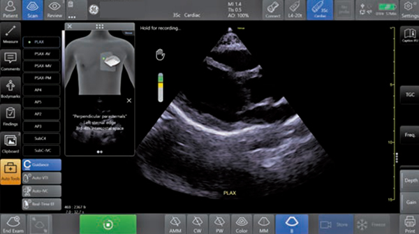 図3　Caption Guidance