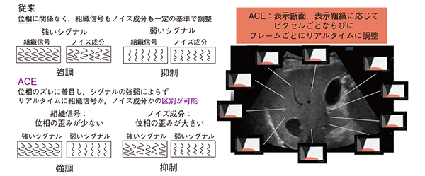 図2　高画質化技術ACEの原理
