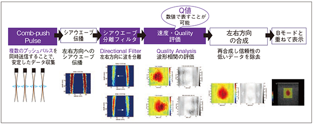 図5　GEヘルスケア SWE独自の3つの技術：画像化までの流れ