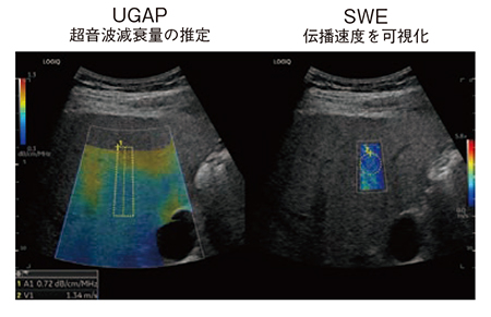 図6　客観性・信頼性の高い UGAP＆SWE