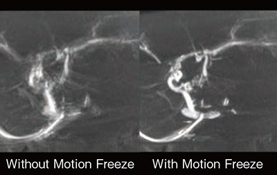 図2　Motion Freeze