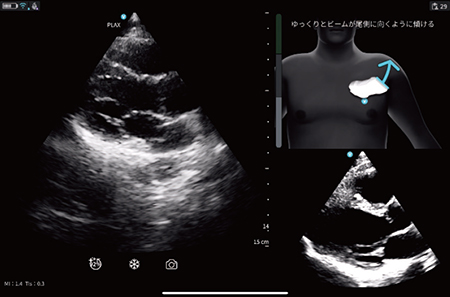 図1　Cardiac Guidance機能