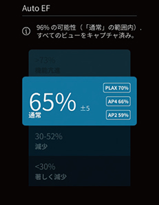 図2　Auto EF機能