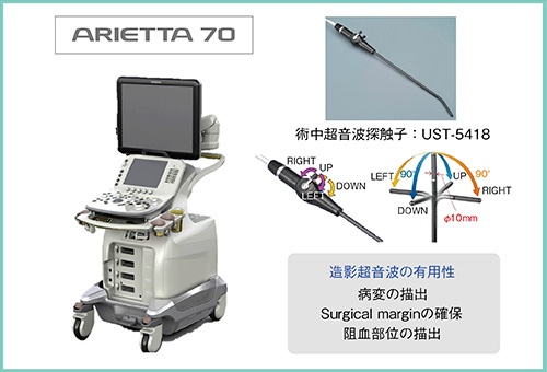 図3　ARIETTA70と術中超音波探触子UST-5418