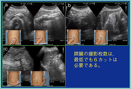 図1　‌膵臓のスクリーニングに必要な超音波画像