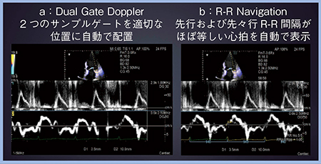 図2　Dual Gate Doppler（a）とR-R Navigation（b）