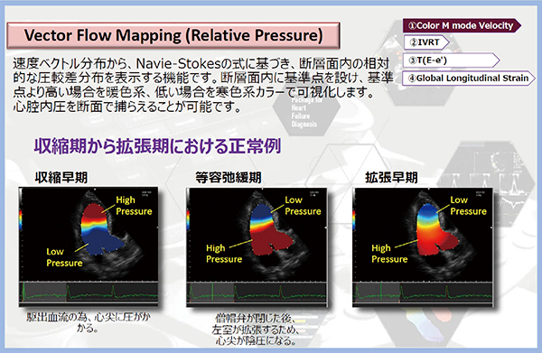図5　Vector Flow Mapping（Relative Pressure Imaging）の概要 （画像提供：株式会社日立製作所）