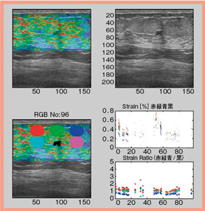 図2　ターゲットが軟らかい場合の各ROIのFLR