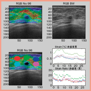 図3　ターゲットが硬い場合の各ROIのFLR