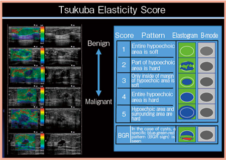 図11　‌‌‌「読みかた」のコツ：つくば弾性スコア（Tsukuba Elasticity Score）