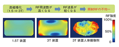 図2　RF照射分布のシミュレーション結果と撮像例