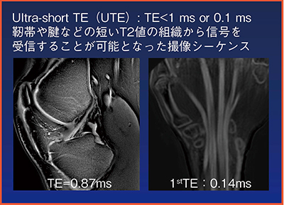 図12　関節領域におけるUltra-short TE