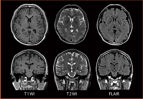 図4　3D FSE（isoFSE）：Sagittal Acquisition Reformat Images