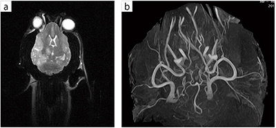 イヌの脳梗塞画像（a）と非造影血管描出（b）