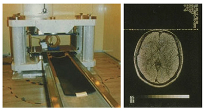 図3　永久磁石型MRI装置のプロトタイプと初めての画像