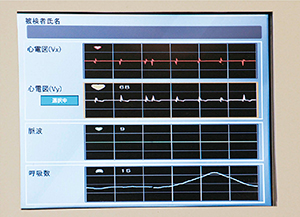 ECHELON OVAL本体のWIT Monitor