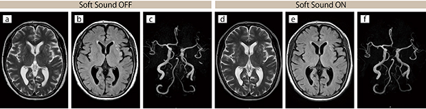 臨床例2：頭部，同一患者比較（症例なし）