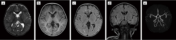■臨床例1：小児頭部（Soft Sound ON）