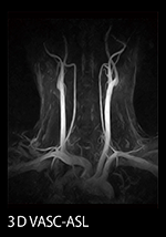 図2　非造影MRA VASC-ASL：頸動脈への適用
