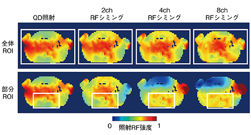 図4　RF照射ch数とRF磁場均一性のシミュレーション例 部分ROI内のRF磁場均一度が4ch以上で良好になることがわかる。