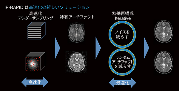 図2　IP-RAPIDの概要