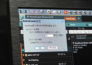 AutoPoseの設定断面を表示後，本スキャンを開始するまでの時間は，タイマー設定が可能。