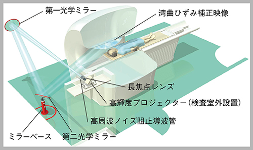 MRIボア内映像投影システム「Smart Theatre」とは？