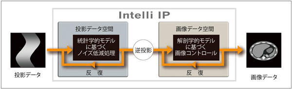 図1　Intelli IP処理概念図