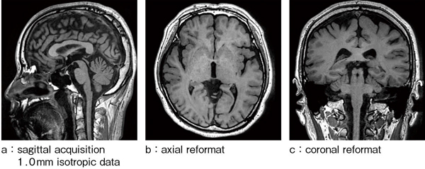図1　isoFSE T1強調画像