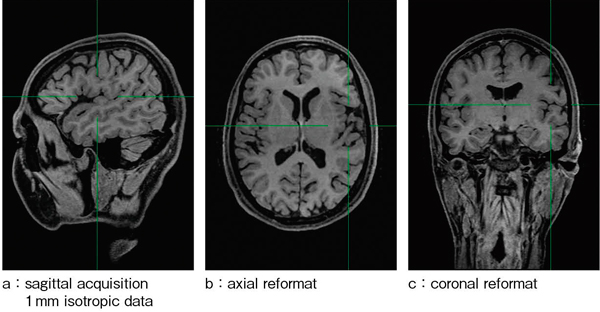 図6　脂肪抑制併用isoFSE T1強調画像（1mm isotropic data） Aq.time 5min 28s