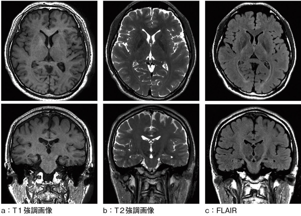 図7　isoFSE reformat image