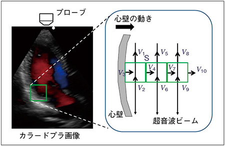 図4　質量保存則に基づく直交方向速度成分の推定