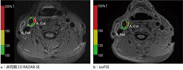図1　SIR Mapの比較